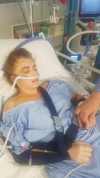 COMA FIGHT: Elise suffered a fractured skull, fractured pelvis, fractured ribs, a fracture to her right leg, a bleed on the brain and five lung clots.